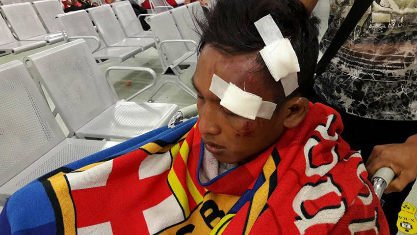 Burmese football fans attacked after match in Malaysia