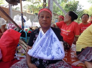 Thaung Khin, 63, said her arm was broken in the scuffle with the black-shirted thugs as she stood in a line and pushed back against them. (PHOTO: DVB)