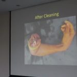 thumb_large_poster_00064