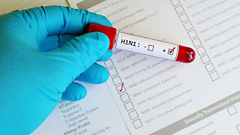 H1N1 death toll in Burma rises to 27