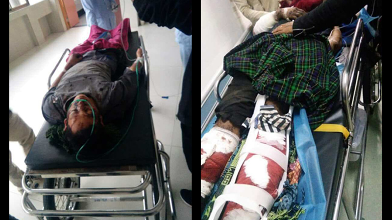 5 injured in Shan State landmine blast